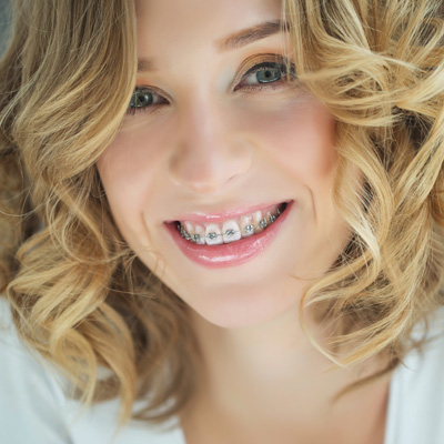 Caring Bear Dental | Teeth Whitening, Space Maintainers and Braces